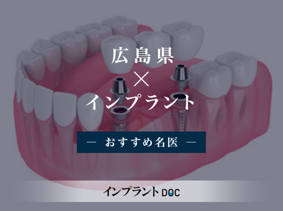 広島インプラント 楽々園インプラント 佐伯区インプラント 海老園インプラント 五日市インプラント 広島市インプラント インプラント名医