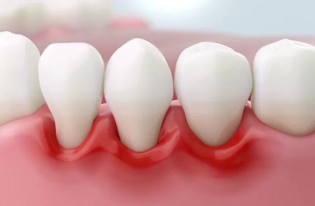 広島市歯医者　佐伯区歯医者　楽々園歯医者　海老園歯医者　廿日市市歯医者　えみたす歯科・矯正歯科　イオンタウン楽々園院　広島市でおすすめの歯医者　定期検診　通いやすい歯医者　歯周病　生活習慣病　予防歯科