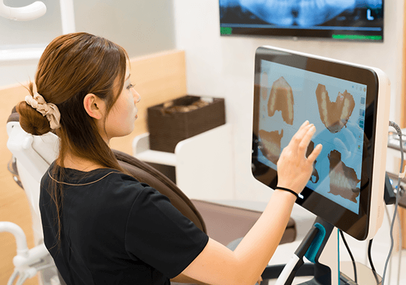 口腔内スキャン（型取り）