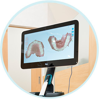 治療前後の変化がシミュレーションでわかる
