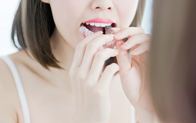 金属アレルギーの心配なし